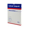 Cuticell Epigraft Kompressen 15x20 cm